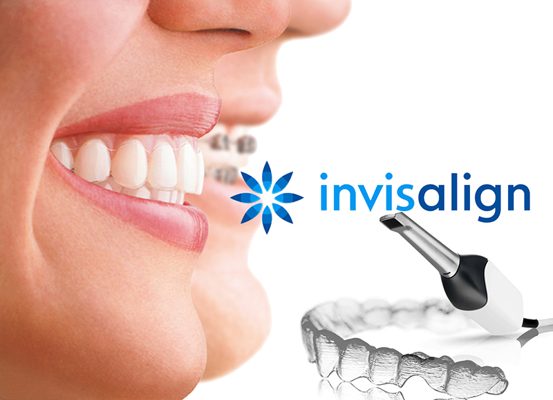 Invisible Aligners For Dental Correction In A Box Stock Photo - Download  Image Now - Dental Aligner, Dental Braces, Malocclusion - iStock